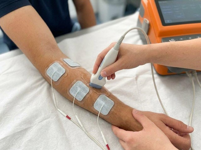 Frena el dolor crónico con EPTE® Neuromodulación en Bueu - Imagen 1