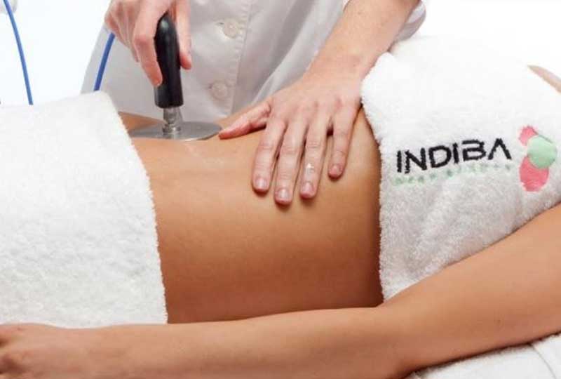 Uso terapéutico de INDIBA en Bueu