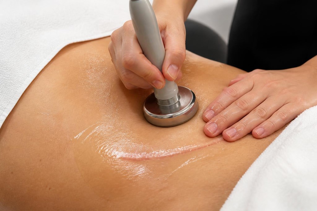 Foto 1 Mejora tus cicatrices con fisioterapia dermatofuncional en Bueu